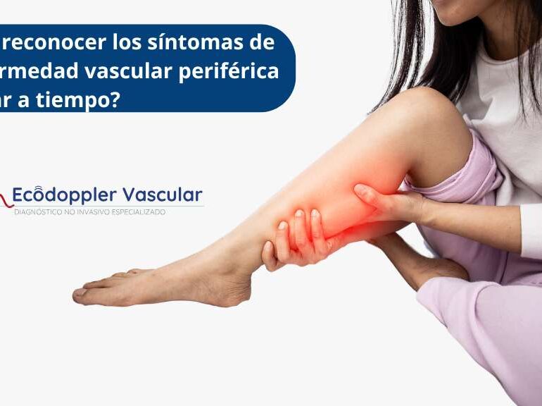Detección de síntomas de la enfermedad vascular periférica con ecografía doppler en Bogotá