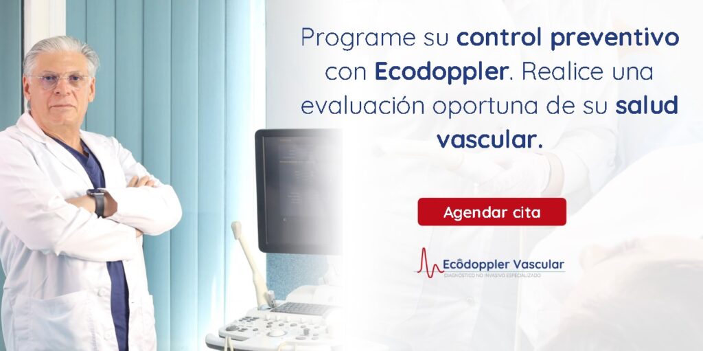 arterias carótidas-Ecodoppler