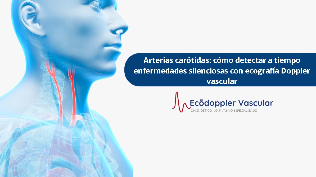 arterias carótidas-Ecodoppler