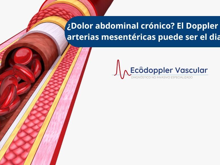 Doppler mesentérico en Ecodoppler Vascular de Bogotá - Ecografía doppler vascular