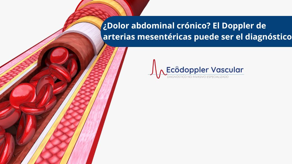 Doppler mesentérico en Ecodoppler Vascular de Bogotá - Ecografía doppler vascular