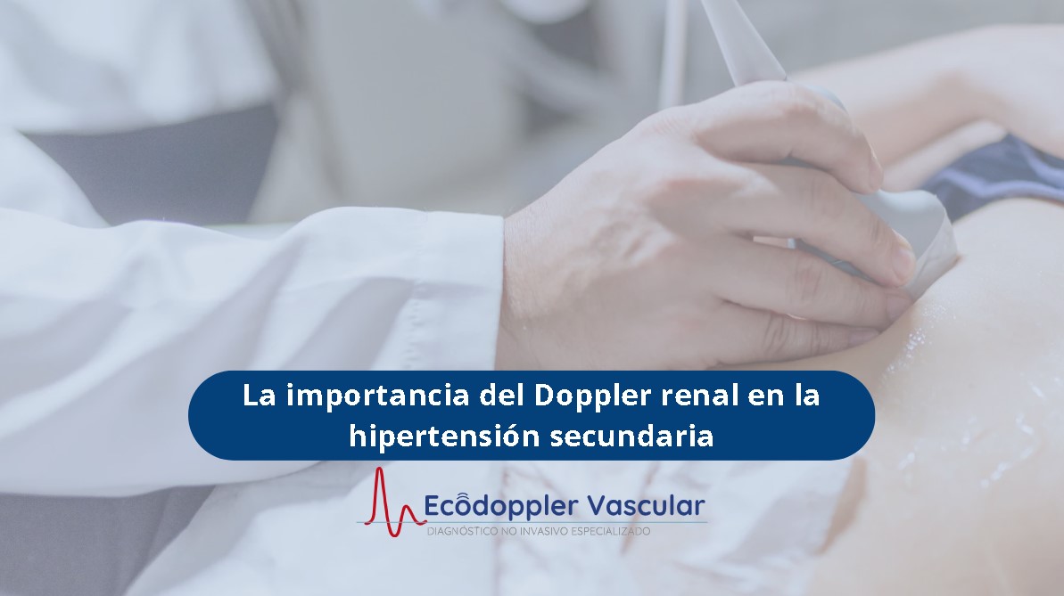 Ecografía doppler renal-Ecodoppler