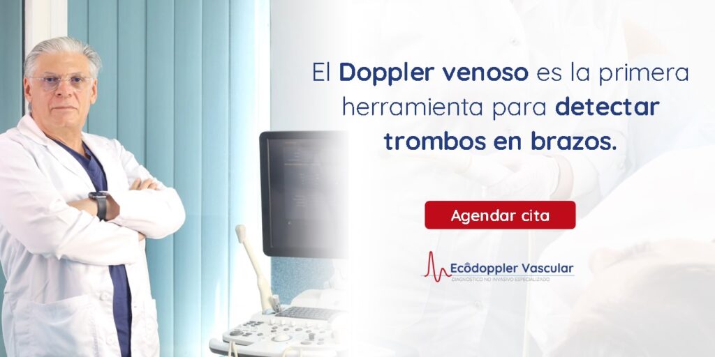 ¿Por qué hacerte un Doppler venoso en los brazos?- Ecodoppler