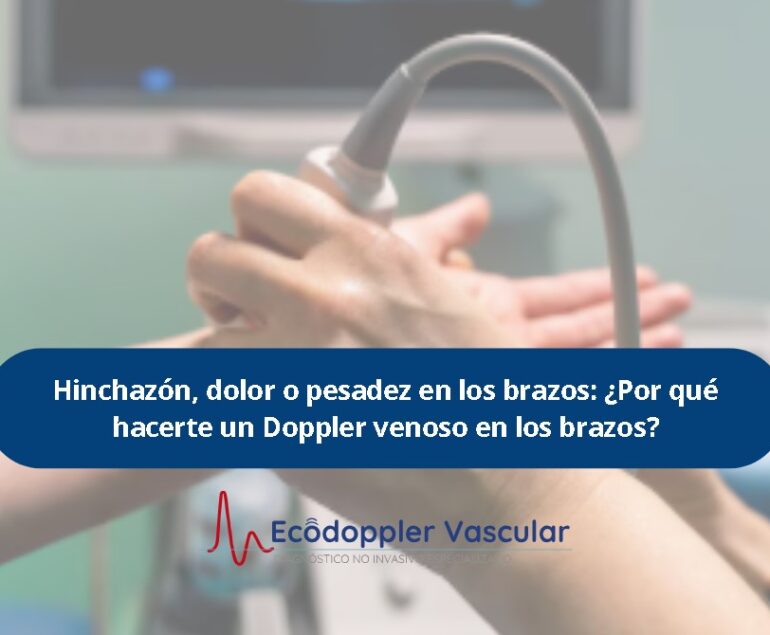 ¿Por qué hacerte un Doppler venoso en los brazos?- Ecodoppler