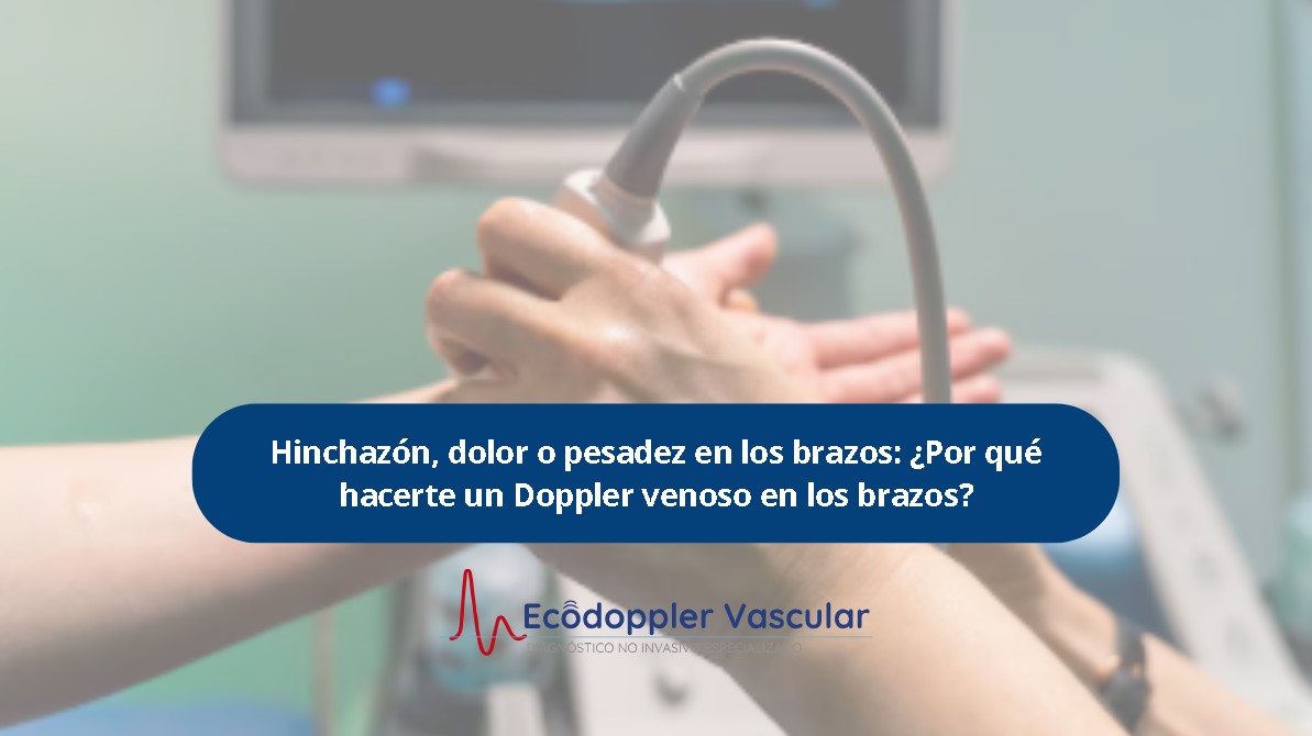 ¿Por qué hacerte un Doppler venoso en los brazos?- Ecodoppler