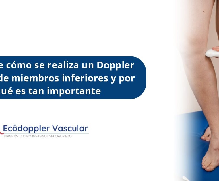 cómo se realiza un doppler venoso de miembros inferiores- Ecodoppler