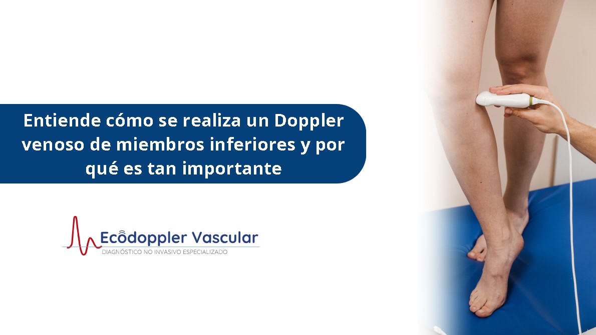 cómo se realiza un doppler venoso de miembros inferiores- Ecodoppler
