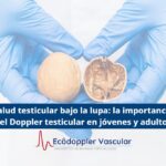 Doppler testicular- Ecodoppler