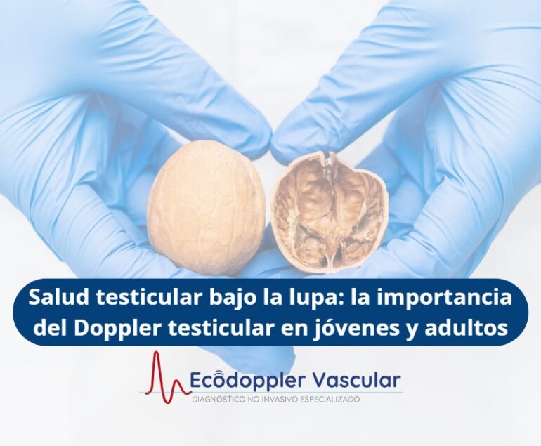 Doppler testicular- Ecodoppler