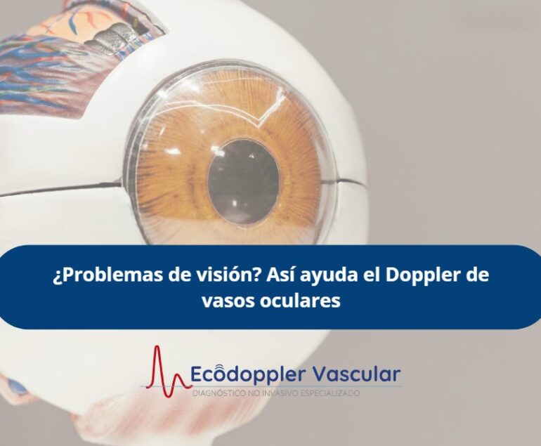 Doppler vasos oculares- Ecodoppler