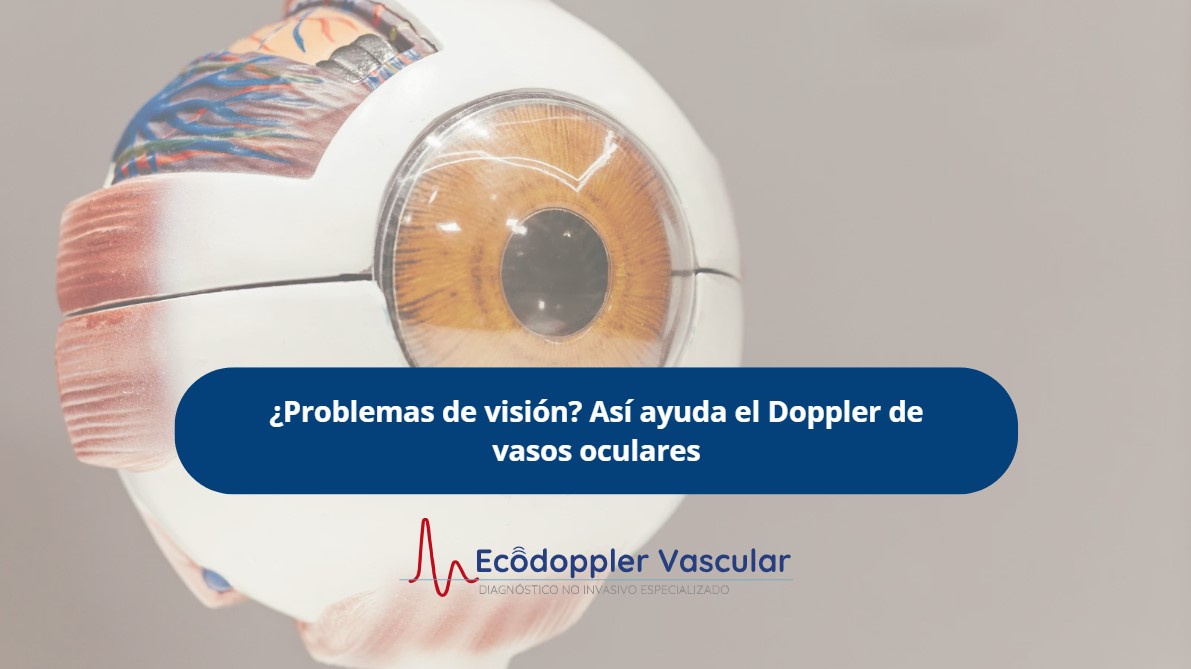Doppler vasos oculares- Ecodoppler