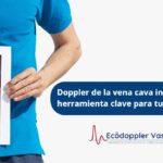 Vena cava inferior- Ecodoppler