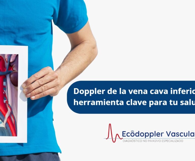 Vena cava inferior- Ecodoppler