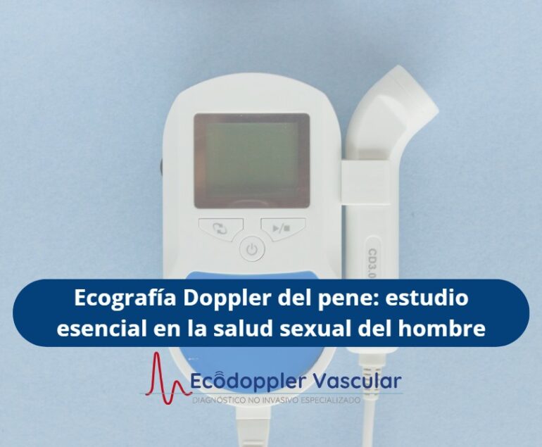 Doppler del pene- Ecodoppler