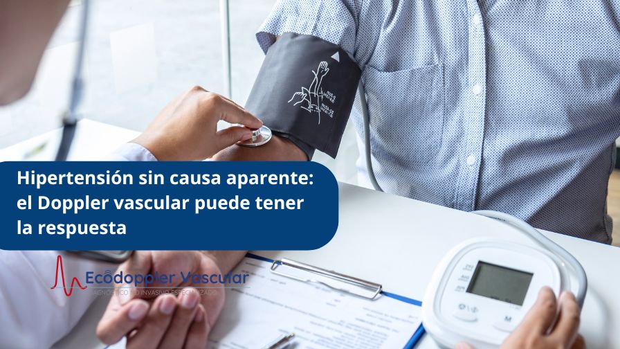 Doppler en hipertensión clave para detectar el origen - Ecodoppler Vascular