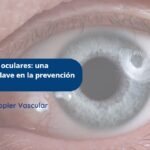 Doppler vasos oculares-Ecodoppler