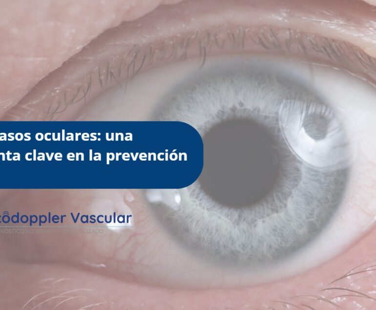 Doppler vasos oculares-Ecodoppler