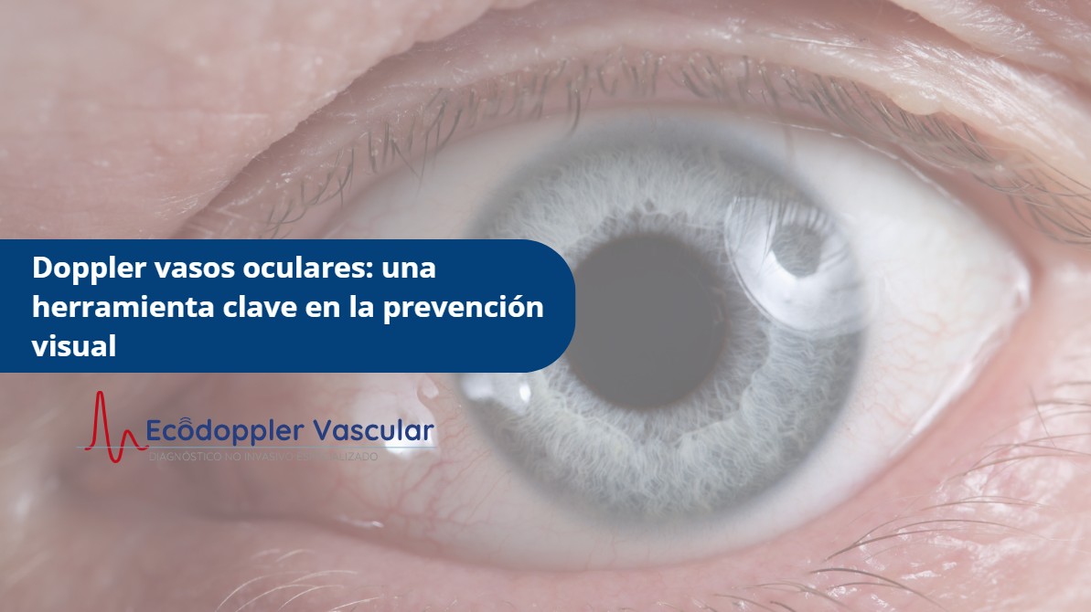Doppler vasos oculares-Ecodoppler