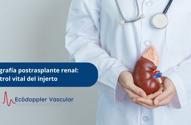 Ecografía postrasplante renal control vital del injerto - Ecodoppler Vascular en Bogotá