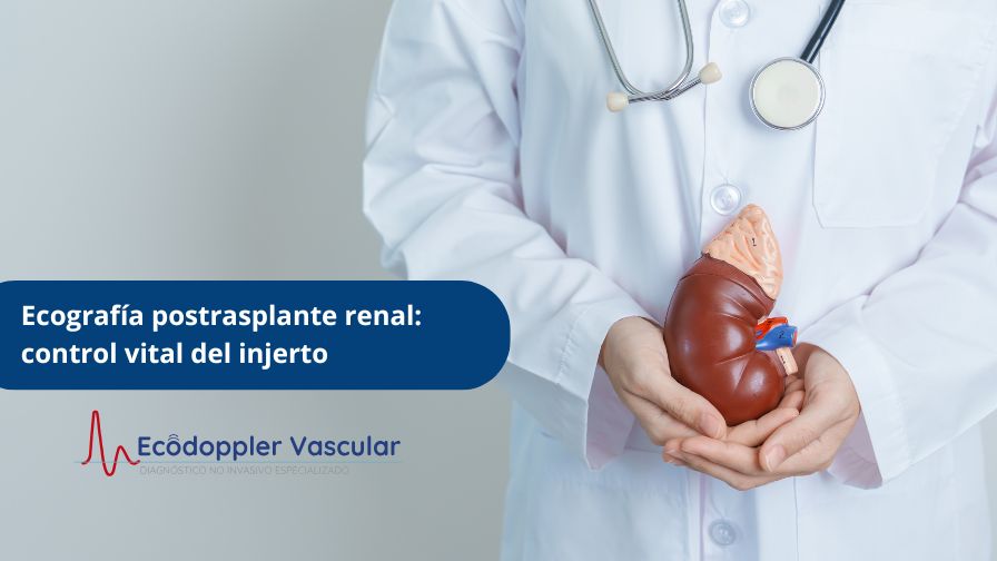 Ecografía postrasplante renal control vital del injerto - Ecodoppler Vascular en Bogotá
