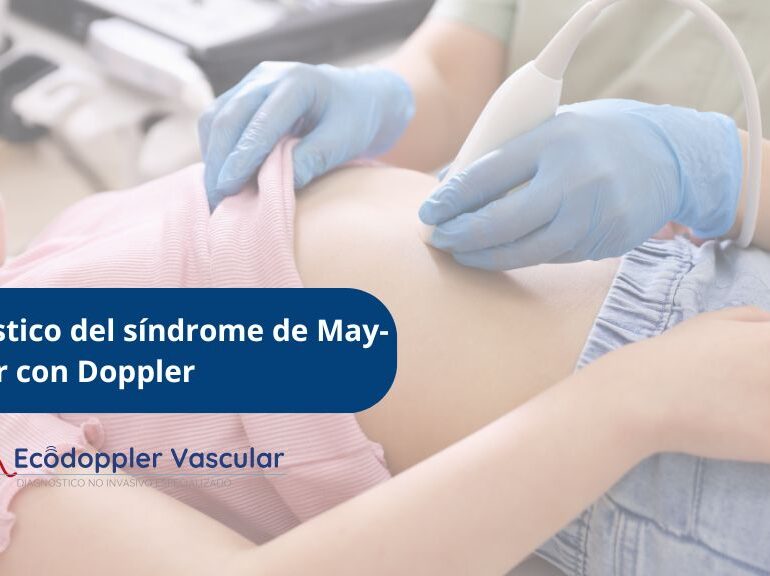 Diagnóstico del síndrome de May-Thurner con ecografía Doppler en Ecodoppler Vascular de Bogotá