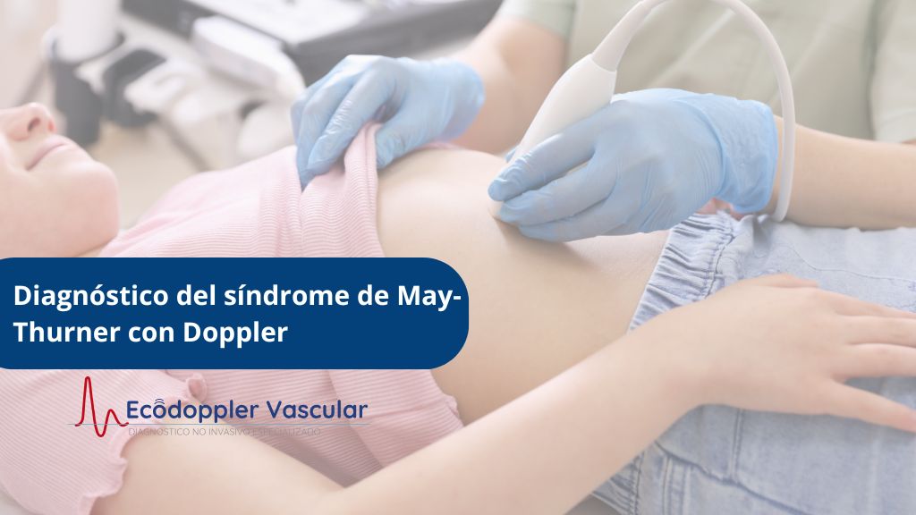 Diagnóstico del síndrome de May-Thurner con ecografía Doppler en Ecodoppler Vascular de Bogotá
