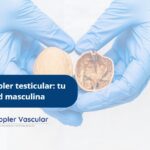 Ecografía Doppler testicular-Ecodoppler