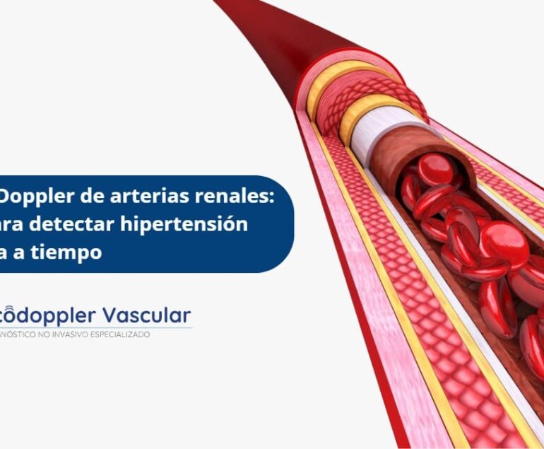 Ecografía doppler de arterias renales-Ecodoppler