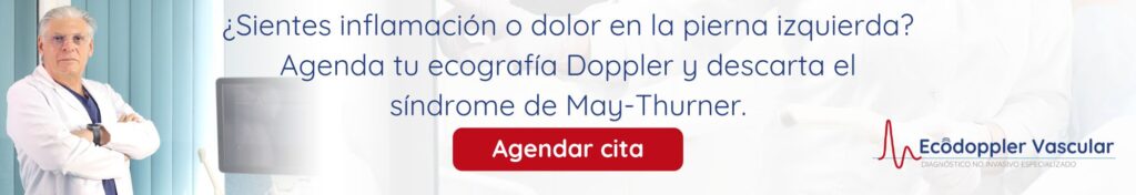 Síndrome de may thurner detectado por ecografía doppler en Bogotá