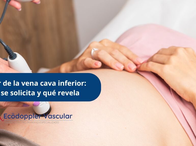 Doppler de la vena cava inferior cuándo se solicita y qué revela - Ecodoppler Vascular