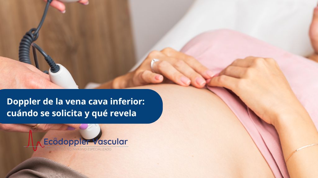 Doppler de la vena cava inferior cuándo se solicita y qué revela - Ecodoppler Vascular