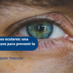 Doppler de vasos oculares-Ecodoppler