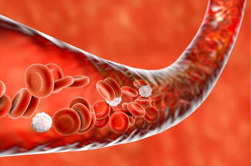 Enfermedad circulatoria detectada por ecografía doppler en Bogotá - Ecodoppler Vascular