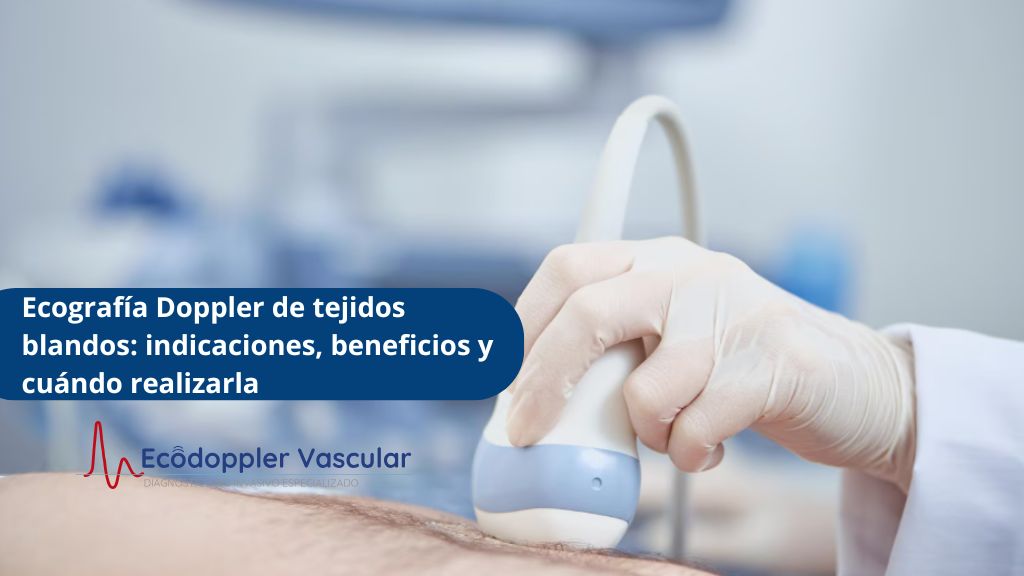 Ecografía Doppler de tejidos blandos en Bogotá - Ecodoppler Vascular