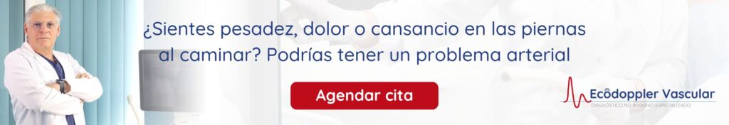 Ecografía Doppler para dolor en las piernas al caminar - Ecodoppler Vascular en Bogotá