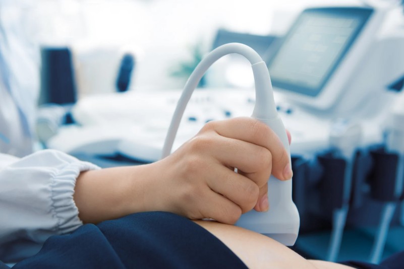 Ecografía pélvica con doppler en Bogotá - Ecodoppler Vascular