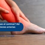 arterias obstruidas en las piernas y su detección con ecografía Doppler en Bogotá