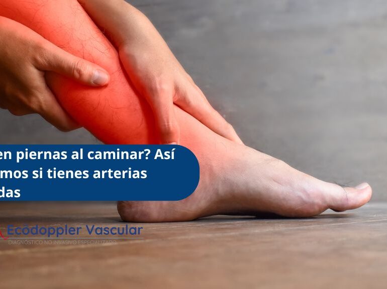 arterias obstruidas en las piernas y su detección con ecografía Doppler en Bogotá