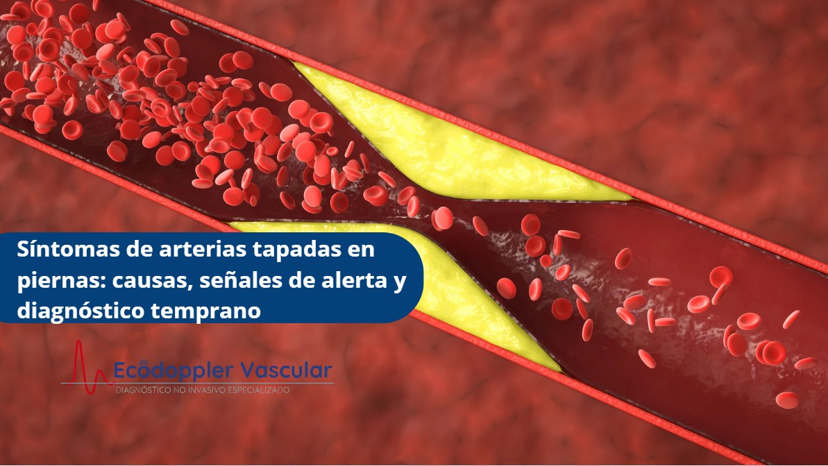 Síntomas de arterias tapadas en piernas-Ecodoppler