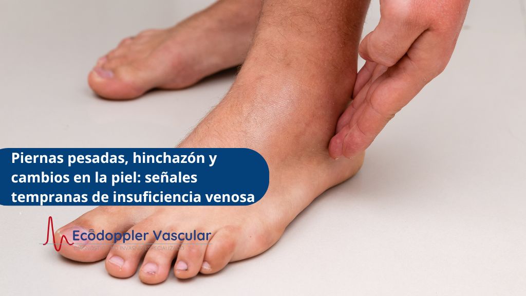 Síntomas de insuficiencia crónica en Bogotá - Ecodoppler Vascular