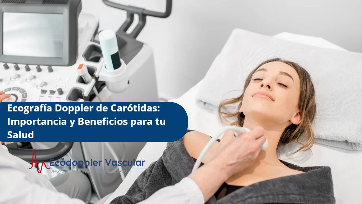 Ecografía Doppler de Carótidas-Ecodoppler