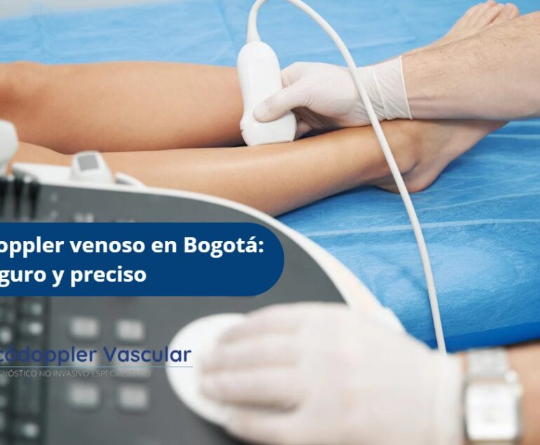 Examen Doppler venoso en Bogotá-Ecodoppler