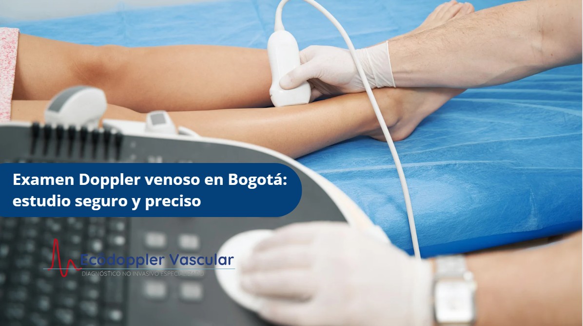 Examen Doppler venoso en Bogotá-Ecodoppler