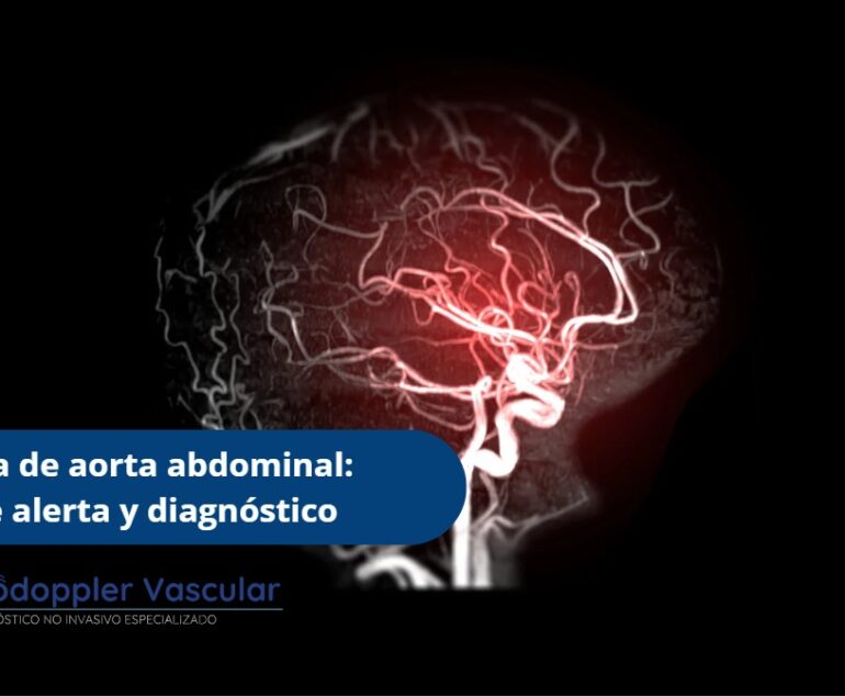 Aneurisma de aorta abdominal-Ecodoppler