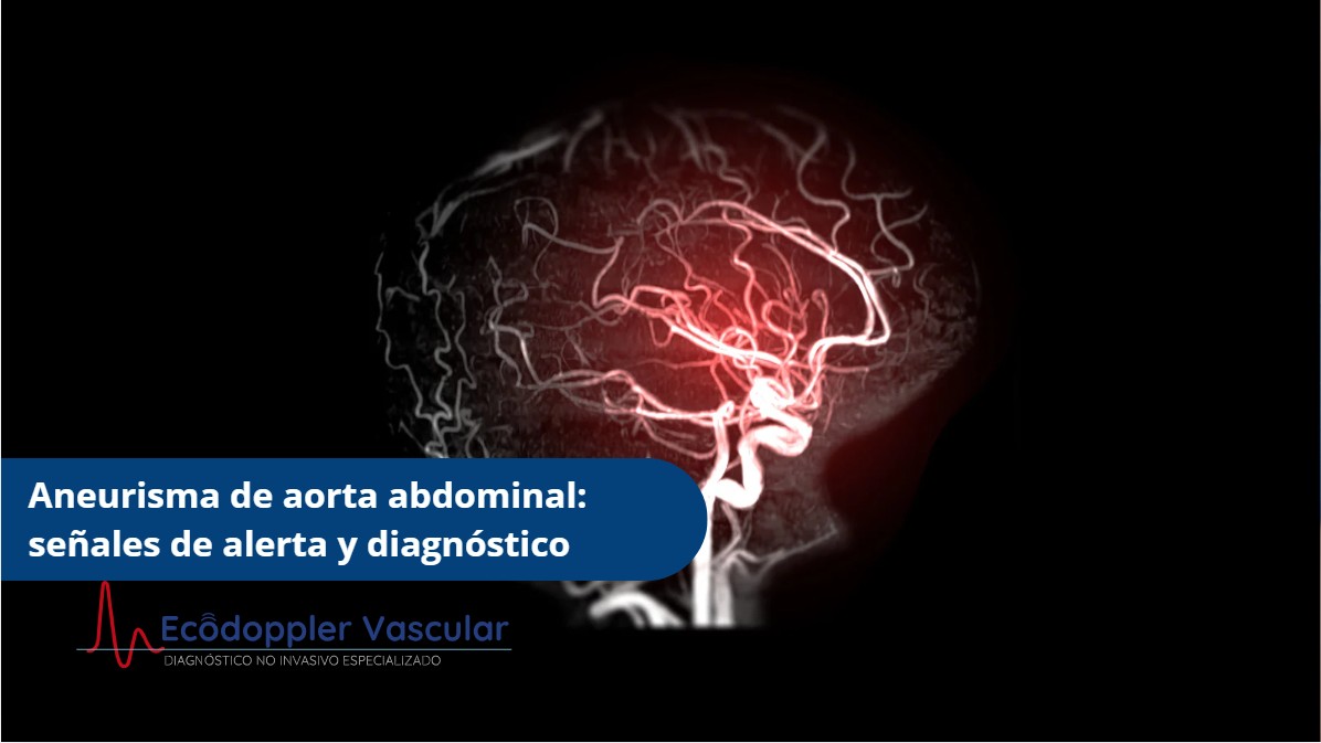 Aneurisma de aorta abdominal-Ecodoppler