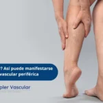 ECODOPPLER - enfermedad vascular periferica