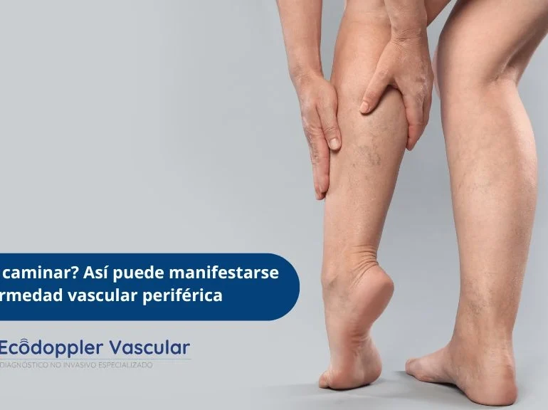 ECODOPPLER - enfermedad vascular periferica
