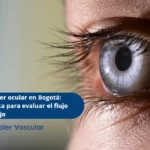 Doppler vasos oculares-Ecodoppler