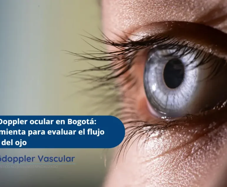 Doppler vasos oculares-Ecodoppler