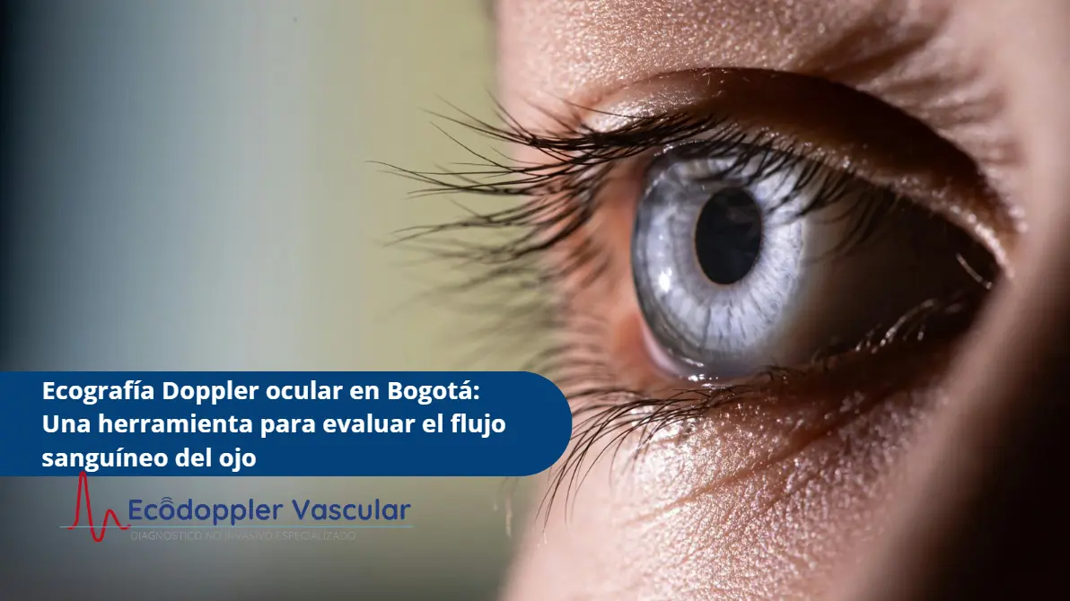 Doppler vasos oculares-Ecodoppler